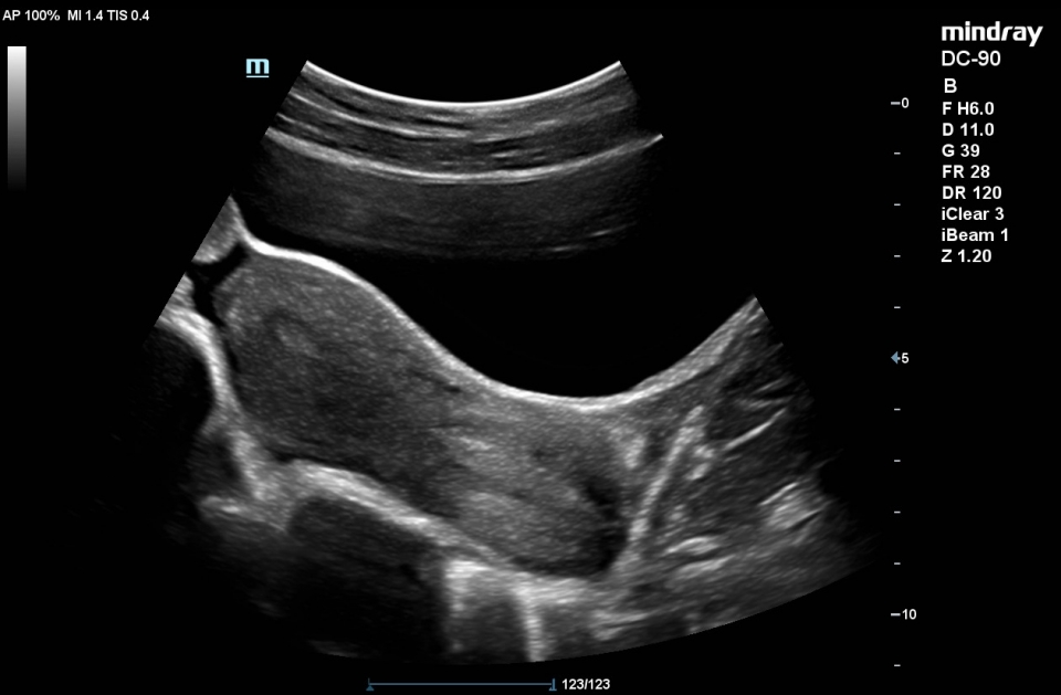 Mindray DC-90 X-insight