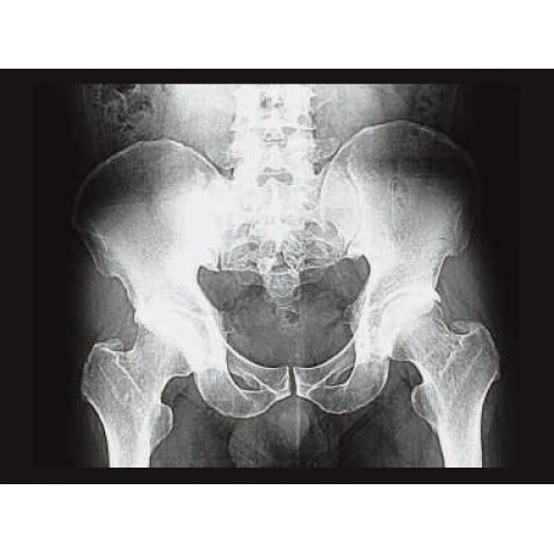 Стационарный рентген GE XR 6000