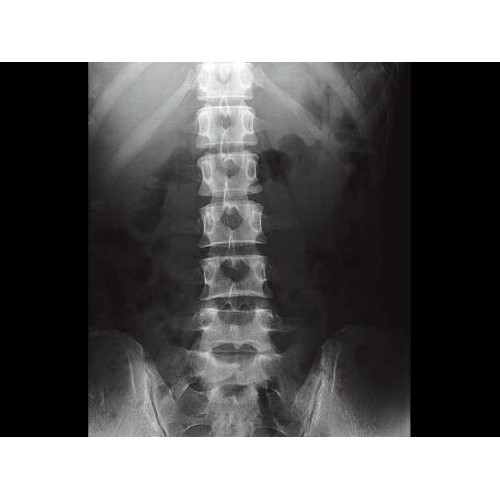 Стационарный рентген GE XR 6000