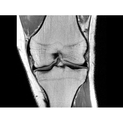 МРТ аппарат GE Optima MR450w 1.5T