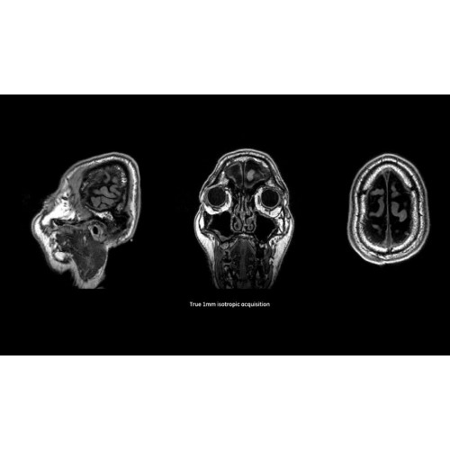 МРТ аппарат GE SIGNA Pioneer 3.0T